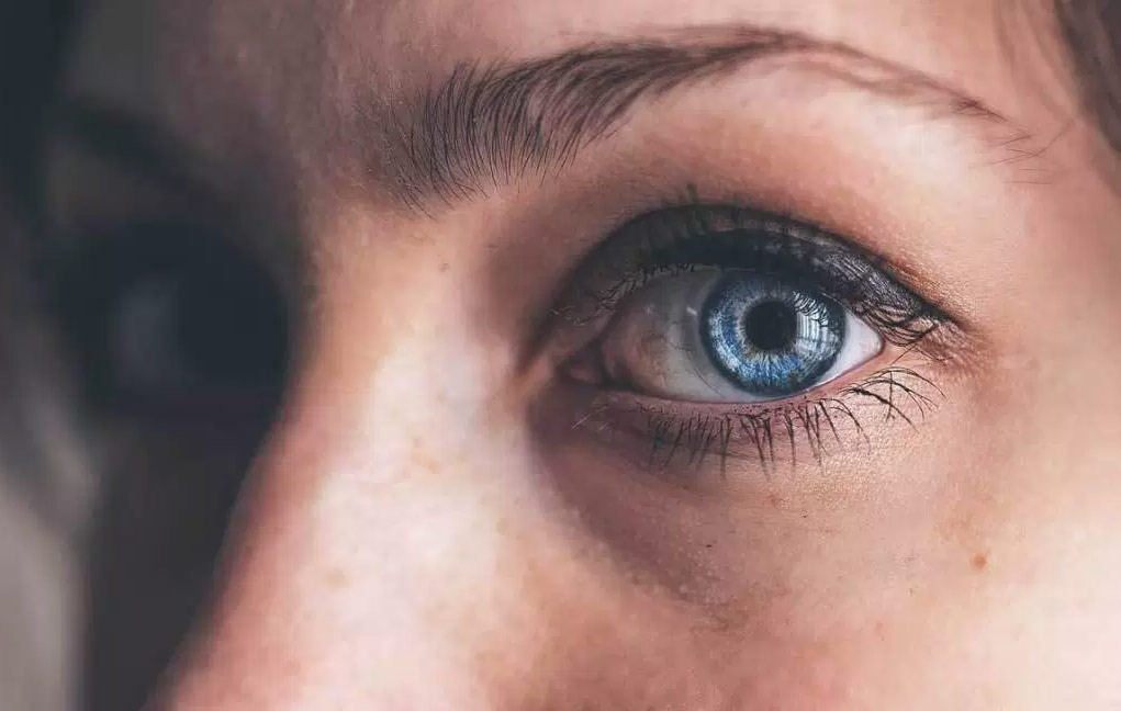 What is Dry Eye